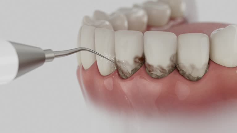Reliable Wisdom Tooth Removal contractor in Madison County County, TN by Dentist Open Now